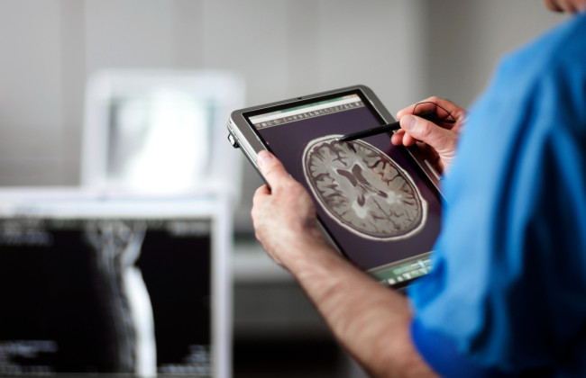 Американські вчені виявили збільшення рівня мікропластику в людському мозку