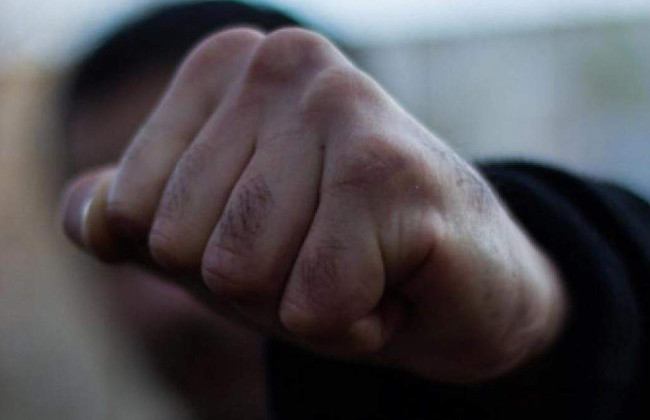 В Одессе напали и избили должностное лицо горсовета