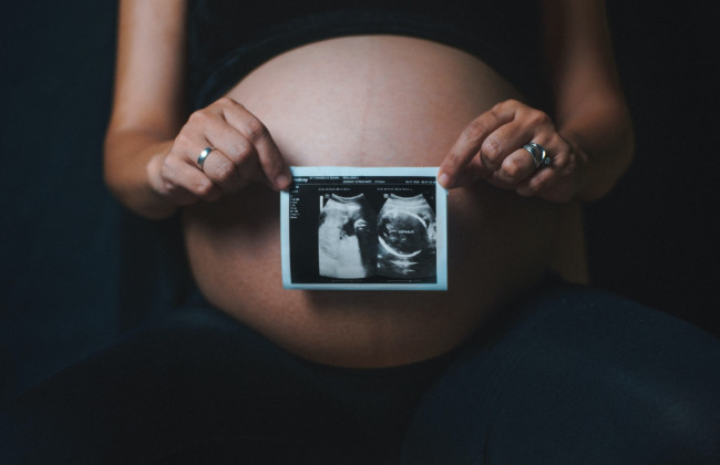 В Минюсте разъяснили, как определить происхождение ребенка при использовании вспомогательных репродуктивных технологий