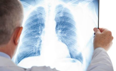 Что следует знать о трудовых гарантиях для работников с туберкулезомом — разъяснение Гоструда