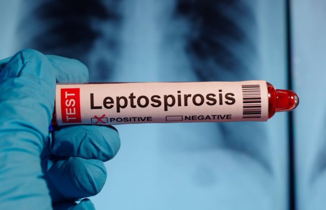 В Украине распространяется смертельно опасная инфекция — как уберечься