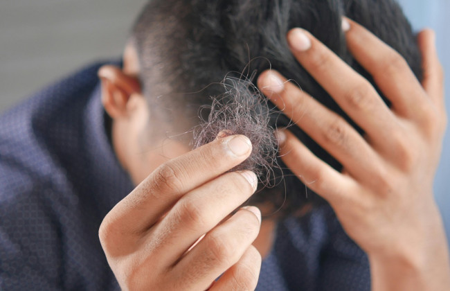 В Индии блогер рекламировал самодельное масло от облысения и оказался на скамье подсудимых