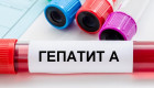 Спалах гепатиту А в Києві — яка ситуація з водою в столичному водосховищі