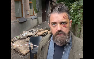 У Києві на режисера із США Крістофера Волтерса, який приїхав документувати війну, впав балкон