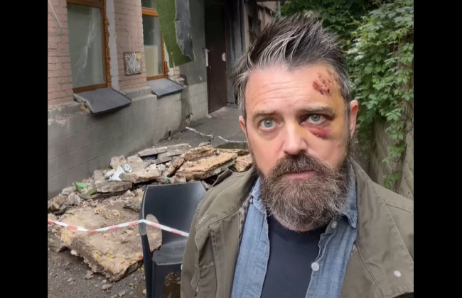 В Киеве на режиссера из США Кристофера Волтерса, который приехал документировать войну, упал балкон