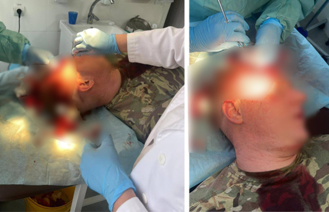 На границе со Словакией группа лиц забросала камнями и кирпичами пограничников