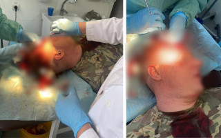 На кордоні зі Словаччиною група осіб закидала камінням та цеглою прикордонників