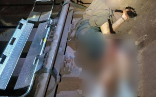 У Києві 19-річний блогер зламав ногу, намагаючись зняти екстремальне відео у метро