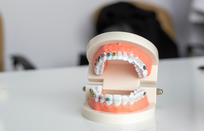 22-річний чоловік із Чехії прикидався стоматологом і лікував людям зуби за уроками з інтернету