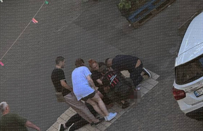 Стрельба в центре Одессы – 25-летнего мужчину ранили в голову