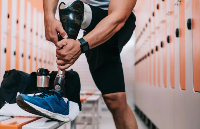 Військові можуть повернути кошти, якщо протез неякісний: ваші права та куди скаржитись