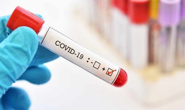 В укрытие с масками — в Киеве резко возросло количество больных коронавирусом с осложнениями