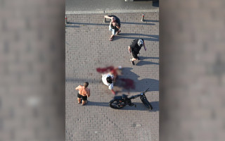 В Киеве собака без поводка покусала женщину и ее питомца