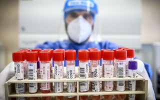 В Украине зафиксированы новые варианты коронавируса Nimbus и Stratus – уже подтверждено 38 случаев