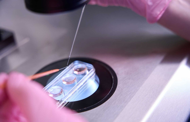 Использование вспомогательных репродуктивных технологий в Украине урегулируют – Кабмин подал законопроект