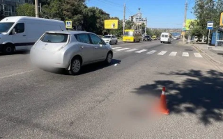 Нетверезий водій збив пішохода в Миколаєві — у 18-річної дівчини розрив селезінки та нирок