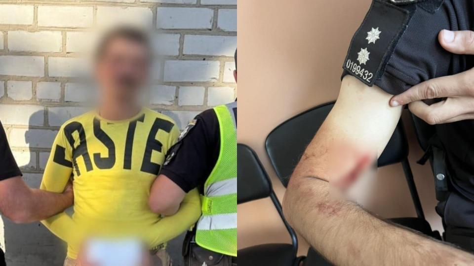 На Кіровоградщині затримали чоловіка, який відкрив вогонь по поліцейських