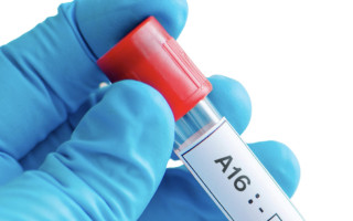 На Київщині зафіксували спалах вірусу Коксакі — які симптоми та як передається