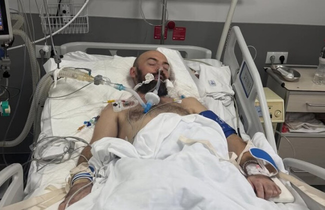 Известный украинский певец из группы ADAM впал в кому из-за туберкулезного менингита