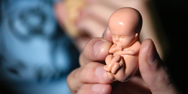 В Шотландии рассматривают разрешение абортов по полу ребенка