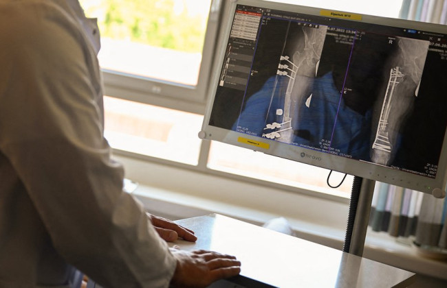 Омбудсман зафіксував різке зростання скарг на роботу медико-соціальної експертизи: у МОЗ пояснили причини затримок