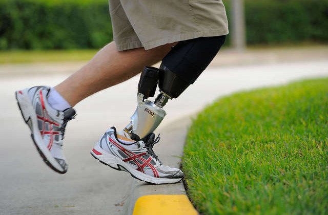 Уряд розширив доступ до протезів і ортезів – як отримати та хто має право