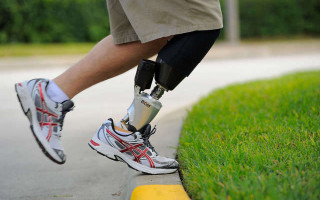 Уряд розширив доступ до протезів і ортезів – як отримати та хто має право