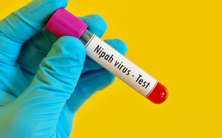 Спалах вірусу Ніпах: перші симптоми, ускладнення та чому його важко виявити