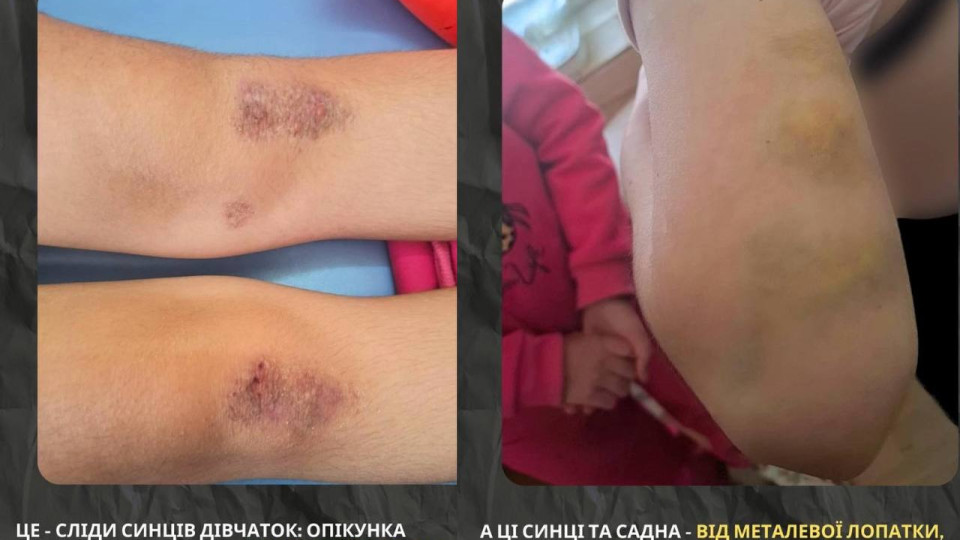 Двое суток на коленях без еды – в Полтавской области опекунку подозревают в пытках младших сестер