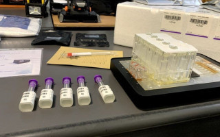 В пяти странах за рубежом стартовал отбор ДНК для поиска пропавших без вести украинцев