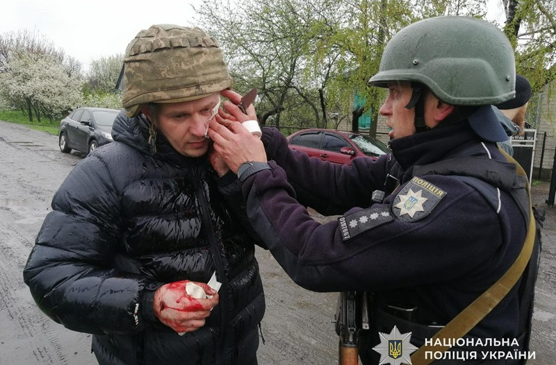На Днепропетровщине мужчина бросил две гранаты в полицейских: есть раненые