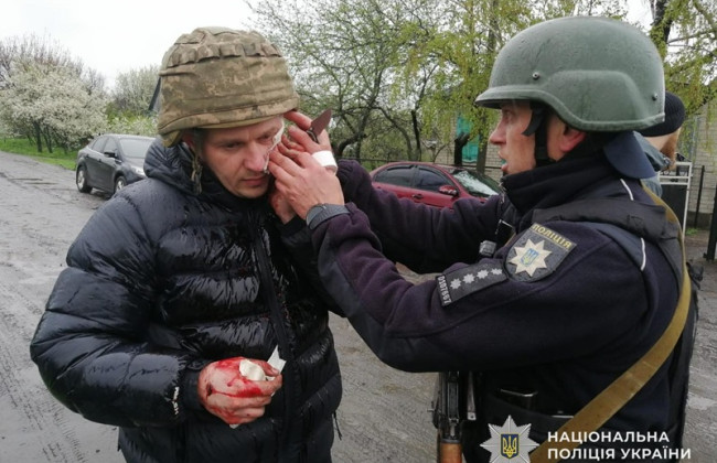 На Дніпропетровщині чоловік кинув дві гранати в поліцейських: є поранені