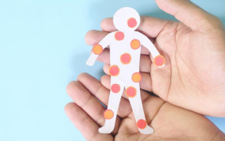 Медики объяснили, как сдержать распространение «ветрянки» среди детей