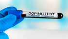 К лицам, которые могут осуществлять допинг-контроль, хотят установить ограничения — законопроект