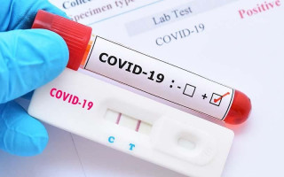 Україна закупить тест-системи на COVID-19 за програмою Світового банку