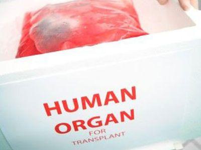 Закон о трансплантации органов хотят изменить