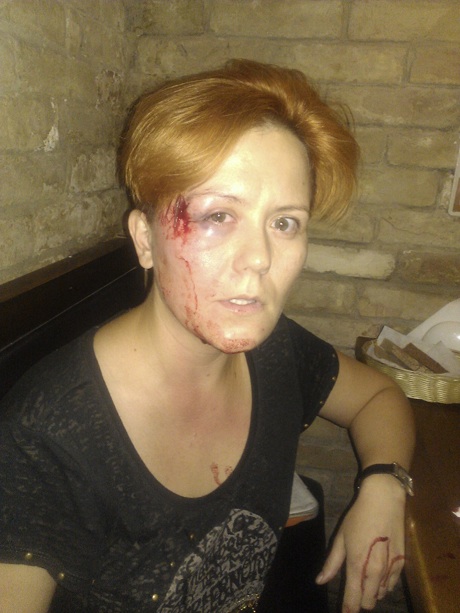 Лидера Femen жестоко избили в киевском кафе