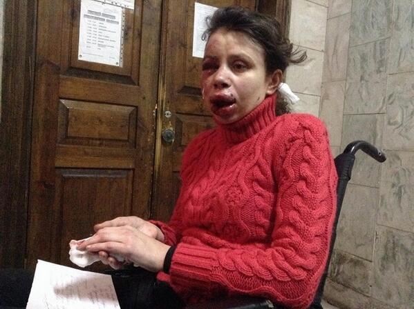 Жестоко избили активистку Евромайдана Татьяну Чорновил. ВИДЕО