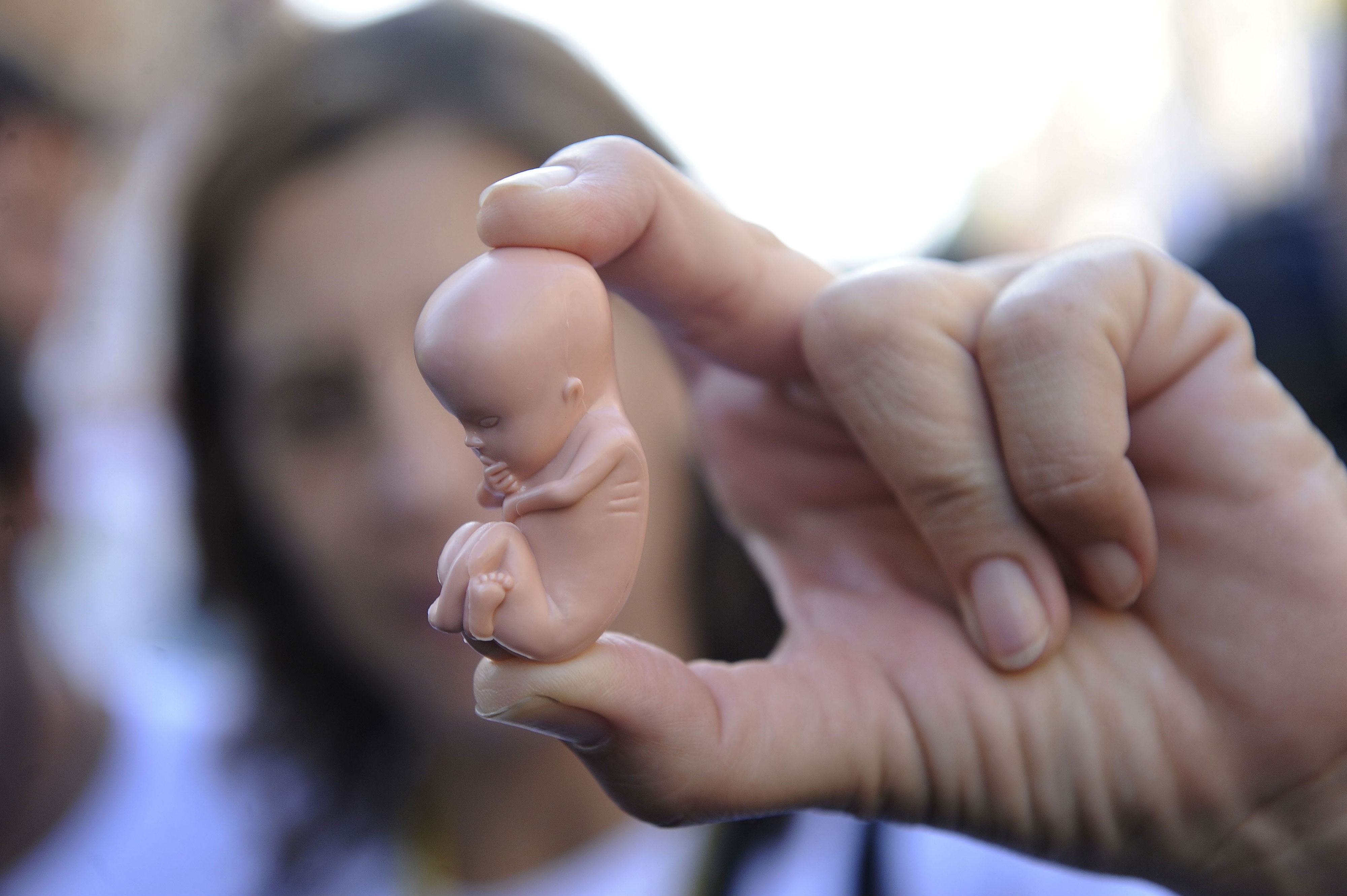 Депутат предложил запретить аборты по желанию женщин